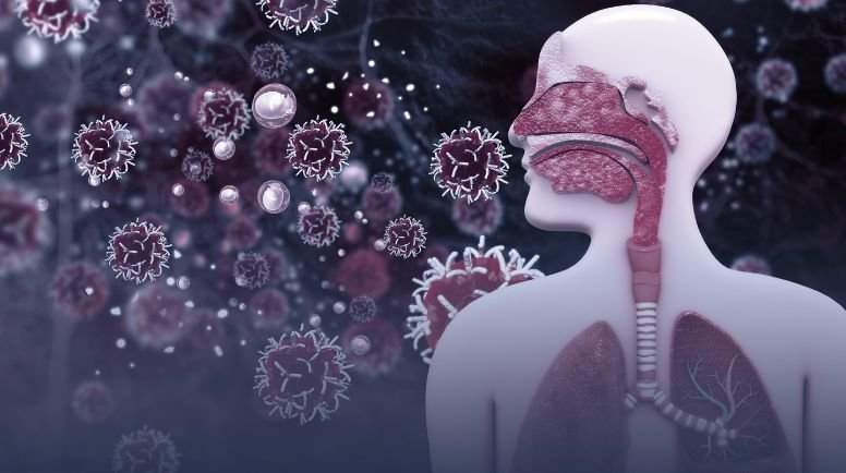 Respiratory Infections